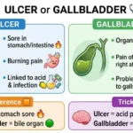 ulcer or gallbladder