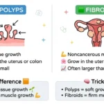 polyps or fibroids